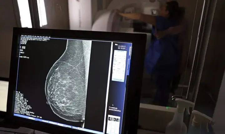 Câncer de mama: uma em cada três pacientes tem menos de 50 anos