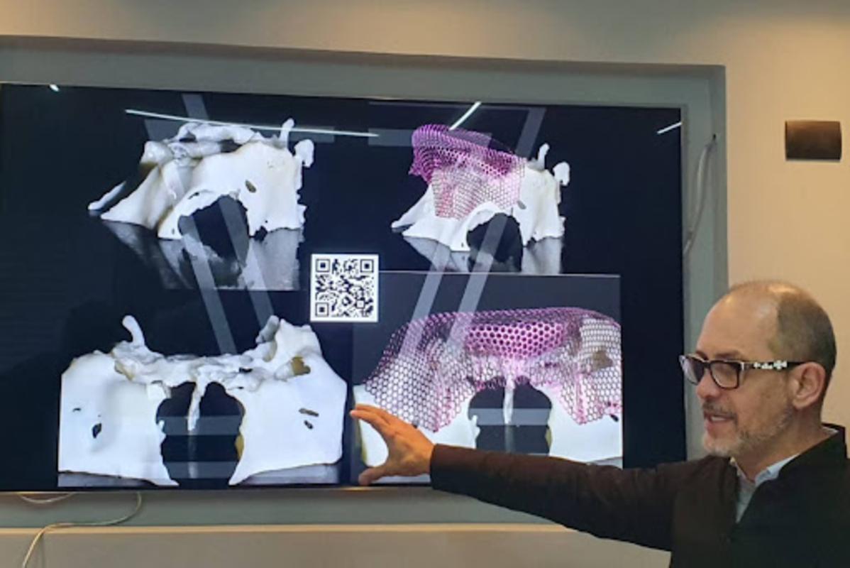 Caso raro de doença fúngica é tratado e vira estudo
